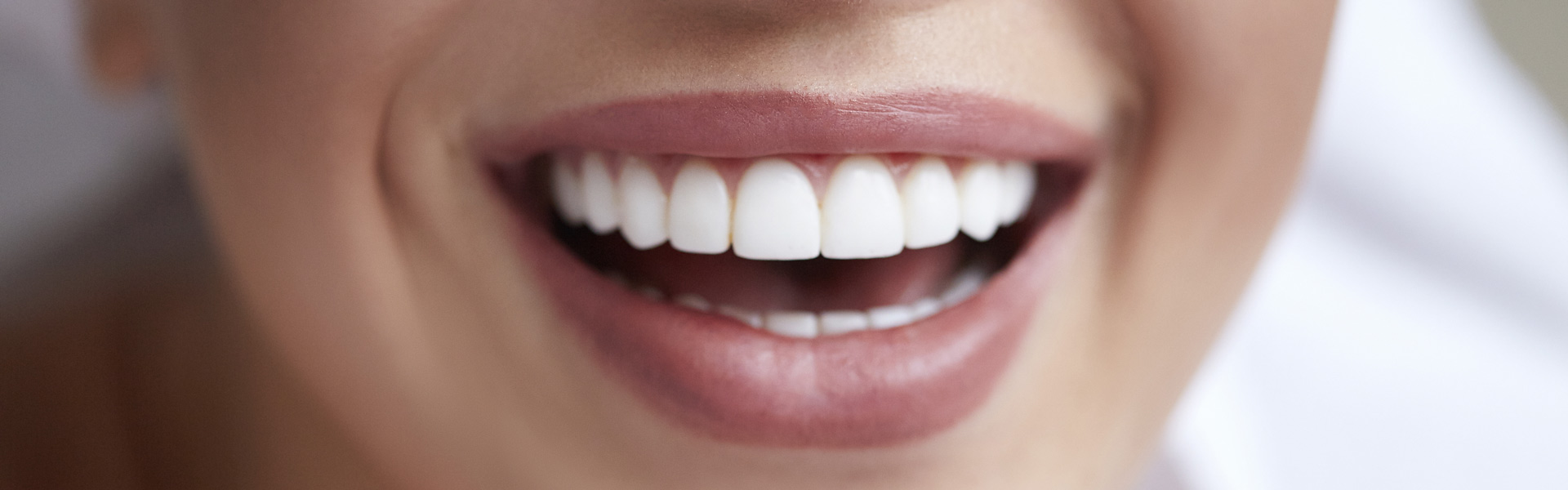 Lachende Patientin mit strahlenden Zähnen