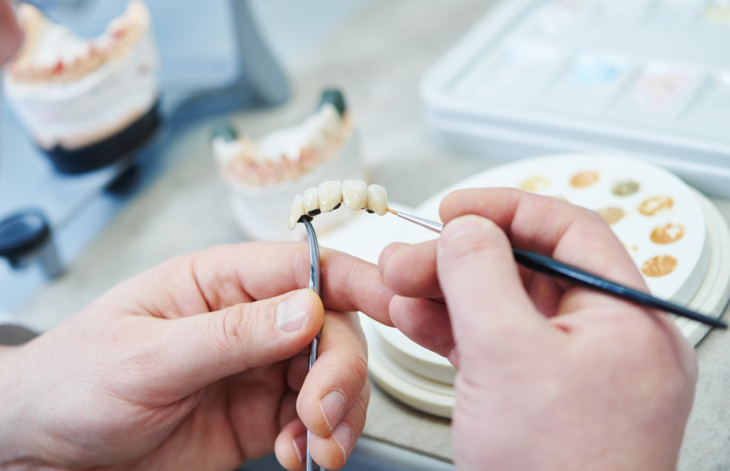 Dental prosthesis work. Painting teeth